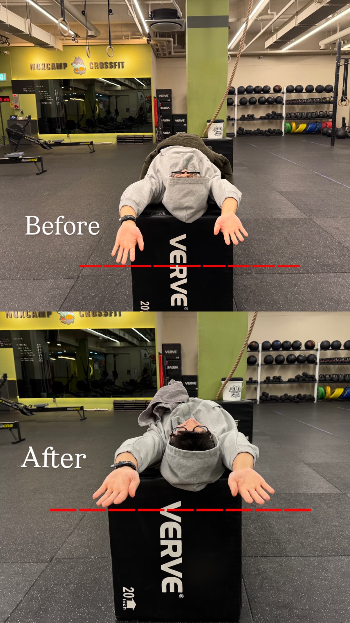 Before & After 3